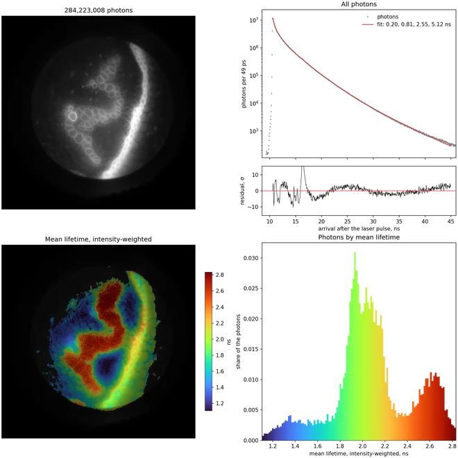 Photons, decay with a four-lifetime fit, mean lifetime map and its histogram for a Convallaria section