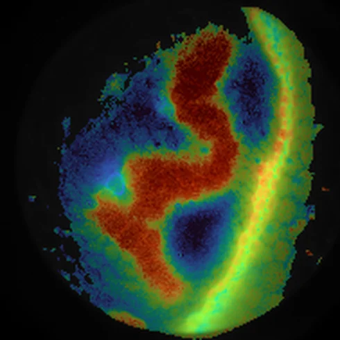A Convallaria section coloured by the mean lifetime of its pixels